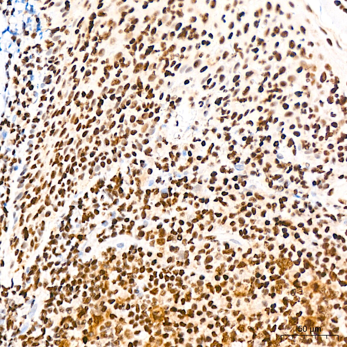 EWSR1 Antibody (9G3H1)
