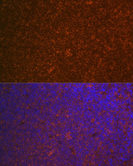 CARD11/CARMA1 Antibody (8N4C9)