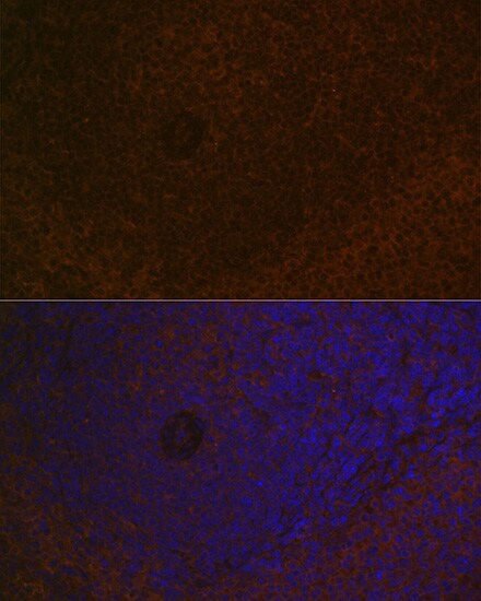 CARD11/CARMA1 Antibody (8N4C9)