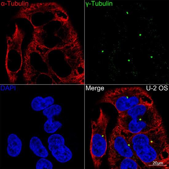 gamma Tubulin Antibody (5R3N3)