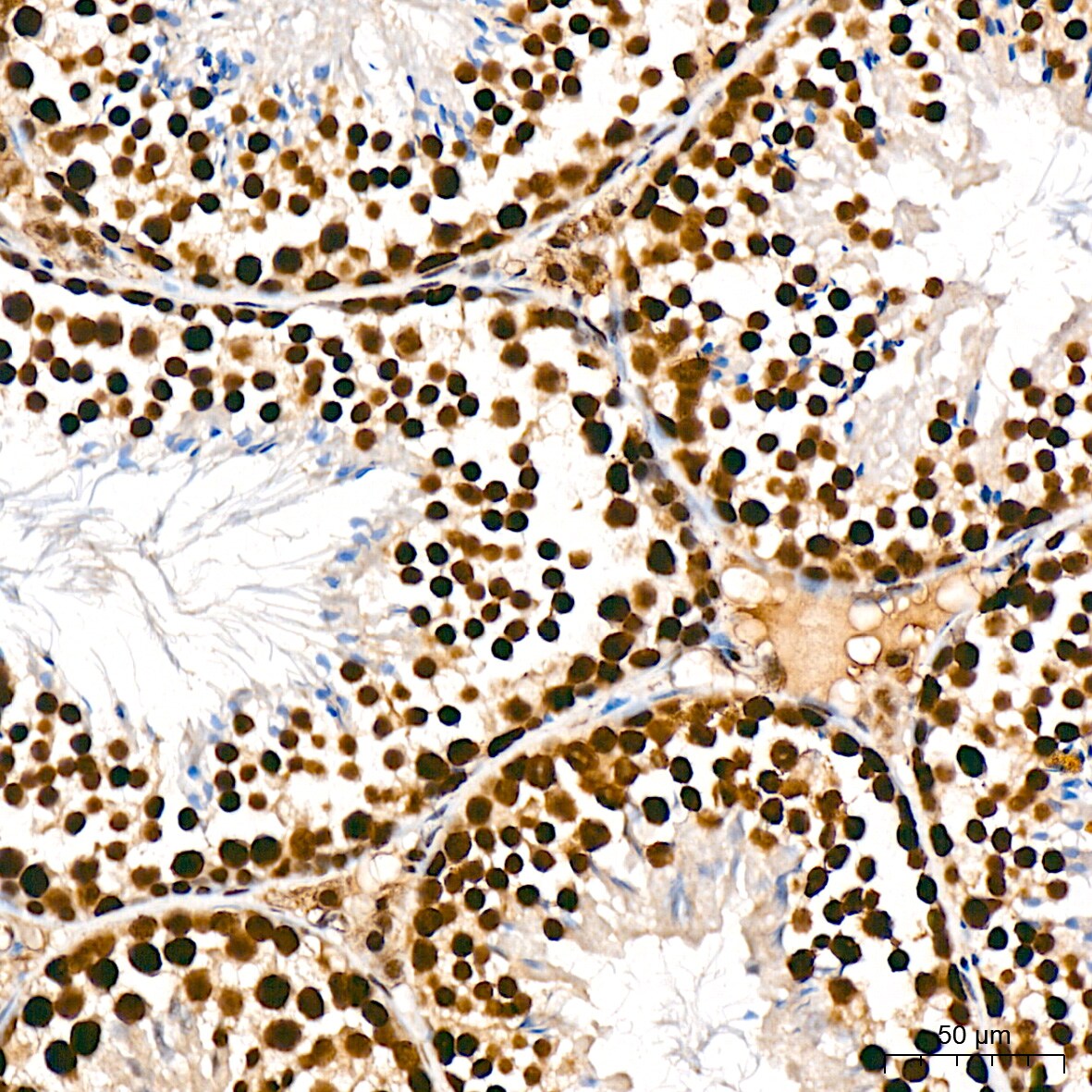 PRP19 Antibody (4M3Z1)