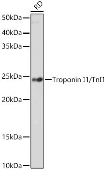 Troponin I Type 1 (slow skeletal) Antibody (5K1U2)