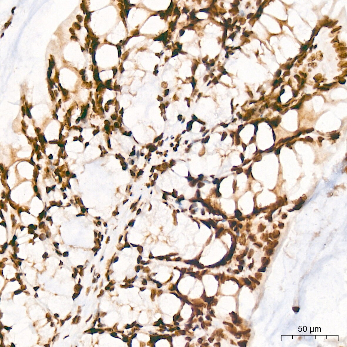 PIAS2/PIAS1 Antibody (8P1D2)