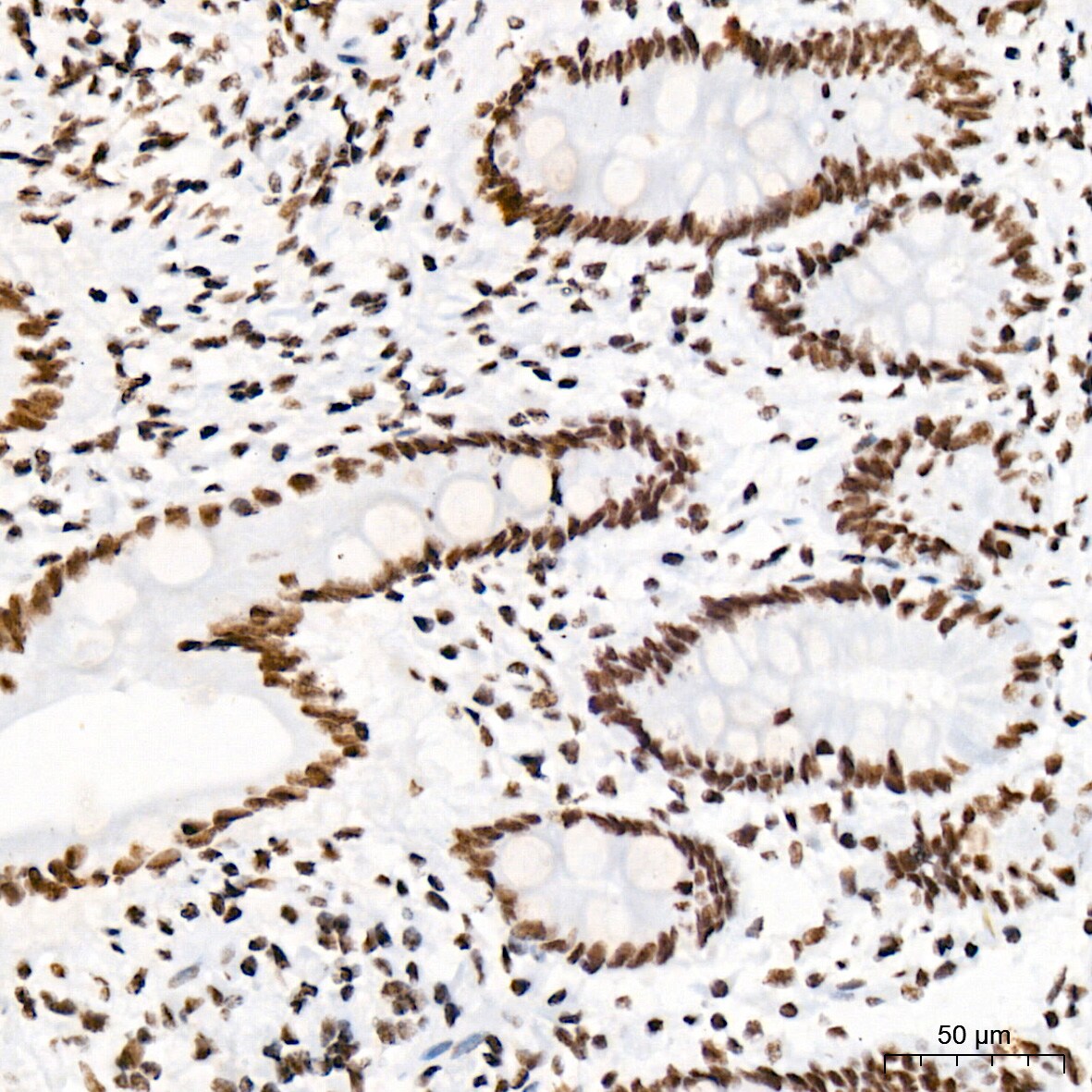 PIAS2/PIAS1 Antibody (8P1D2)