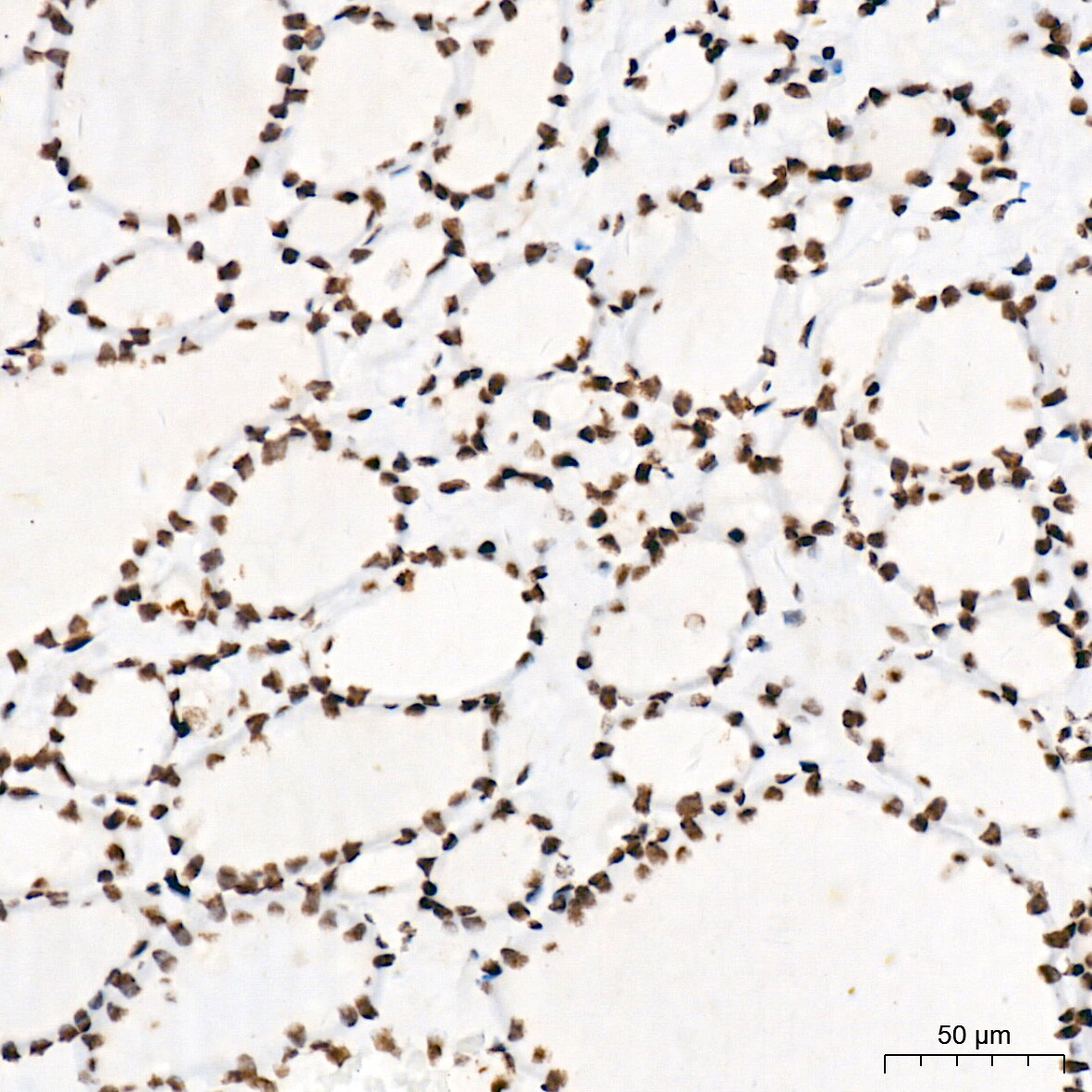 PIAS2/PIAS1 Antibody (8P1D2)