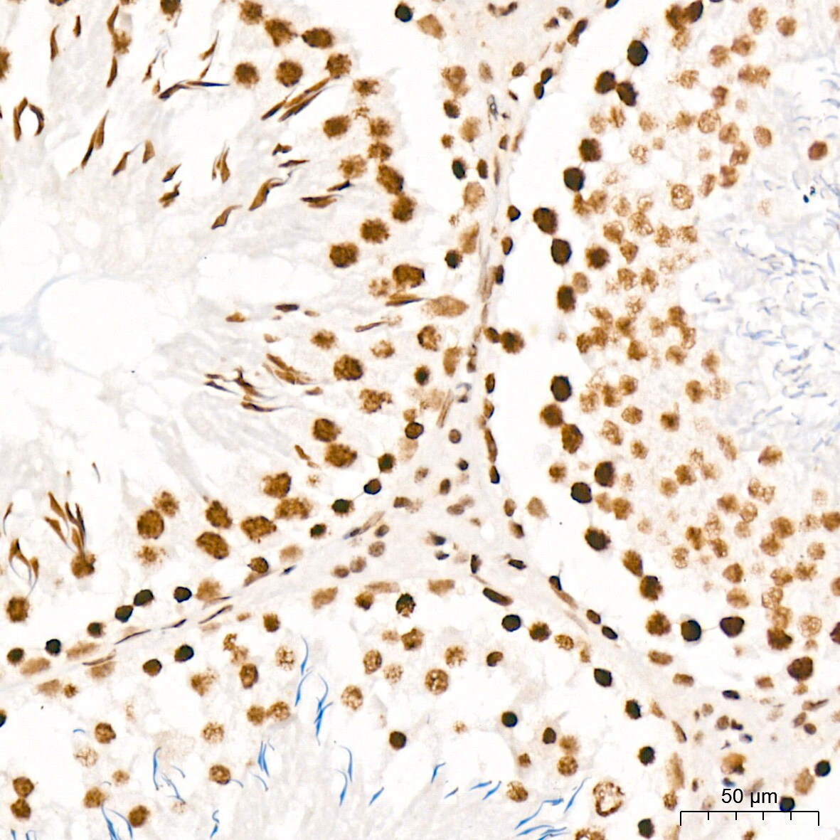 PIAS2/PIAS1 Antibody (8P1D2)