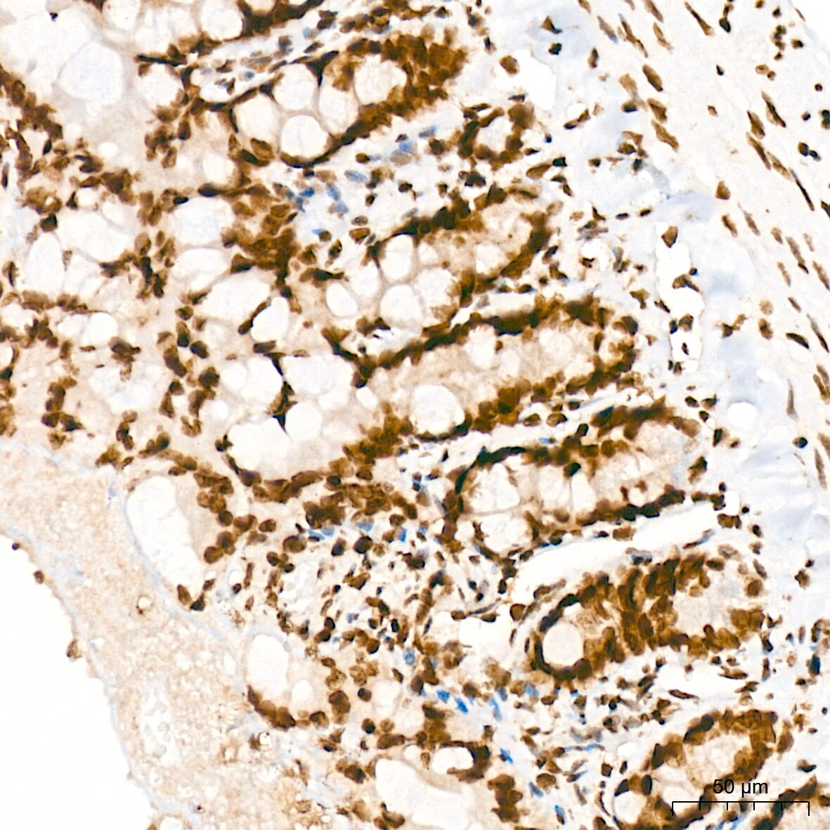PIAS2/PIAS1 Antibody (8P1D2)