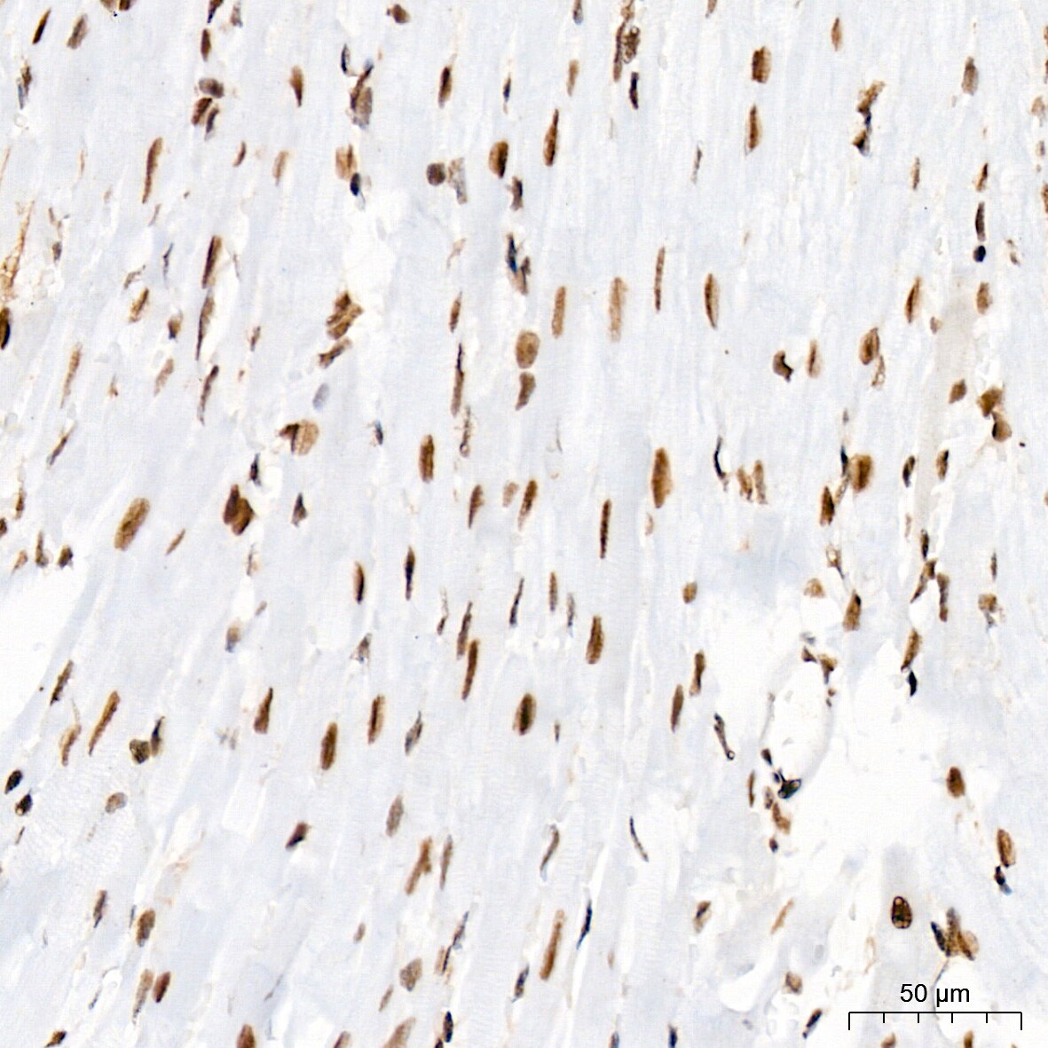 PIAS2/PIAS1 Antibody (8P1D2)