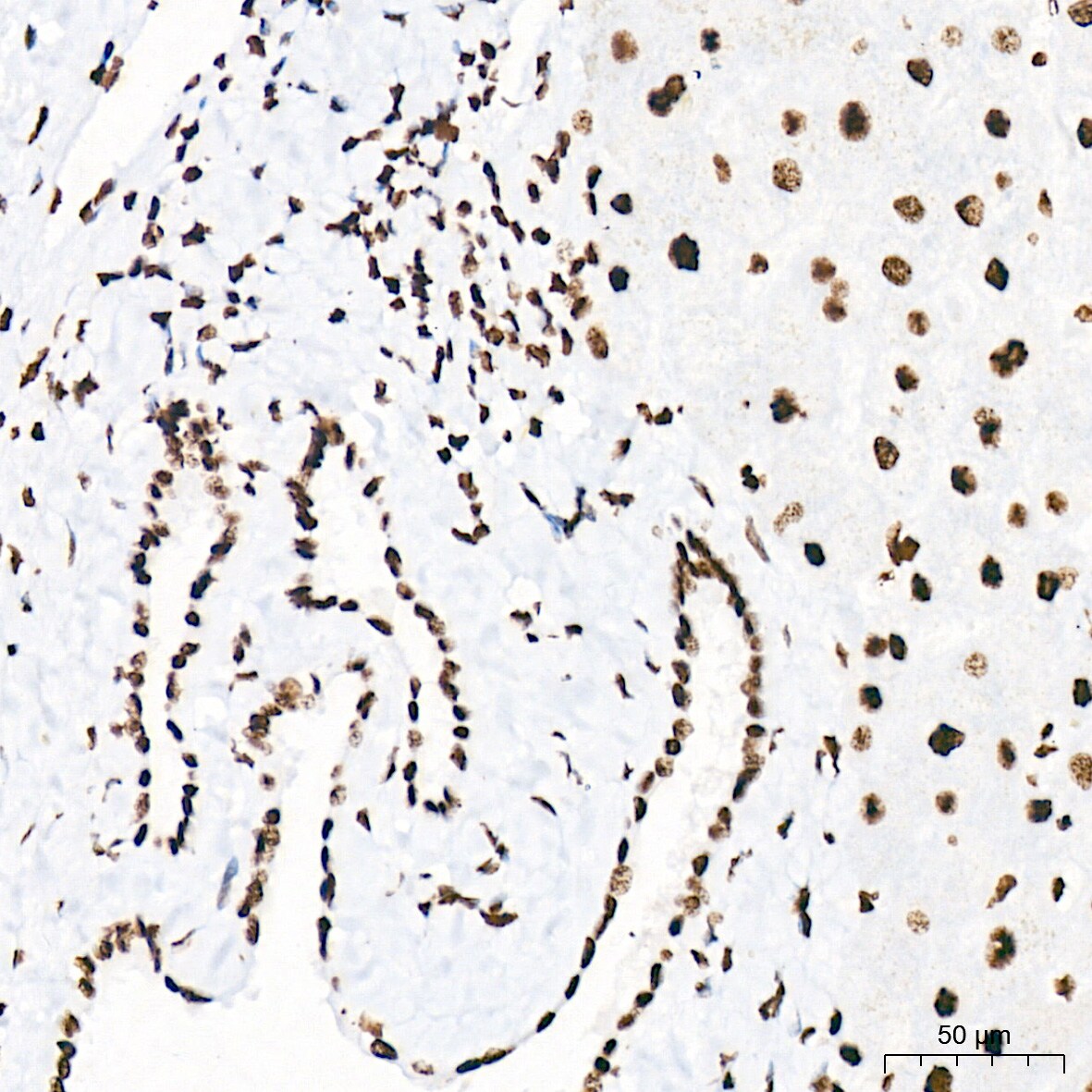 PIAS2/PIAS1 Antibody (8P1D2)