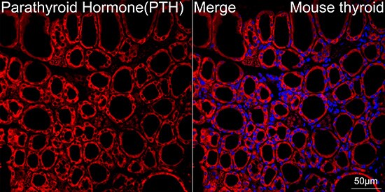 PTH Antibody (5X6R6)
