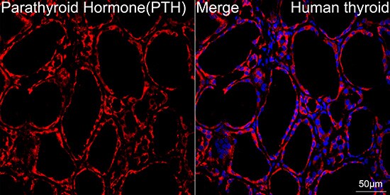 PTH Antibody (5X6R6)