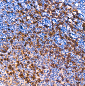 eIF2A Antibody (8V8H7)