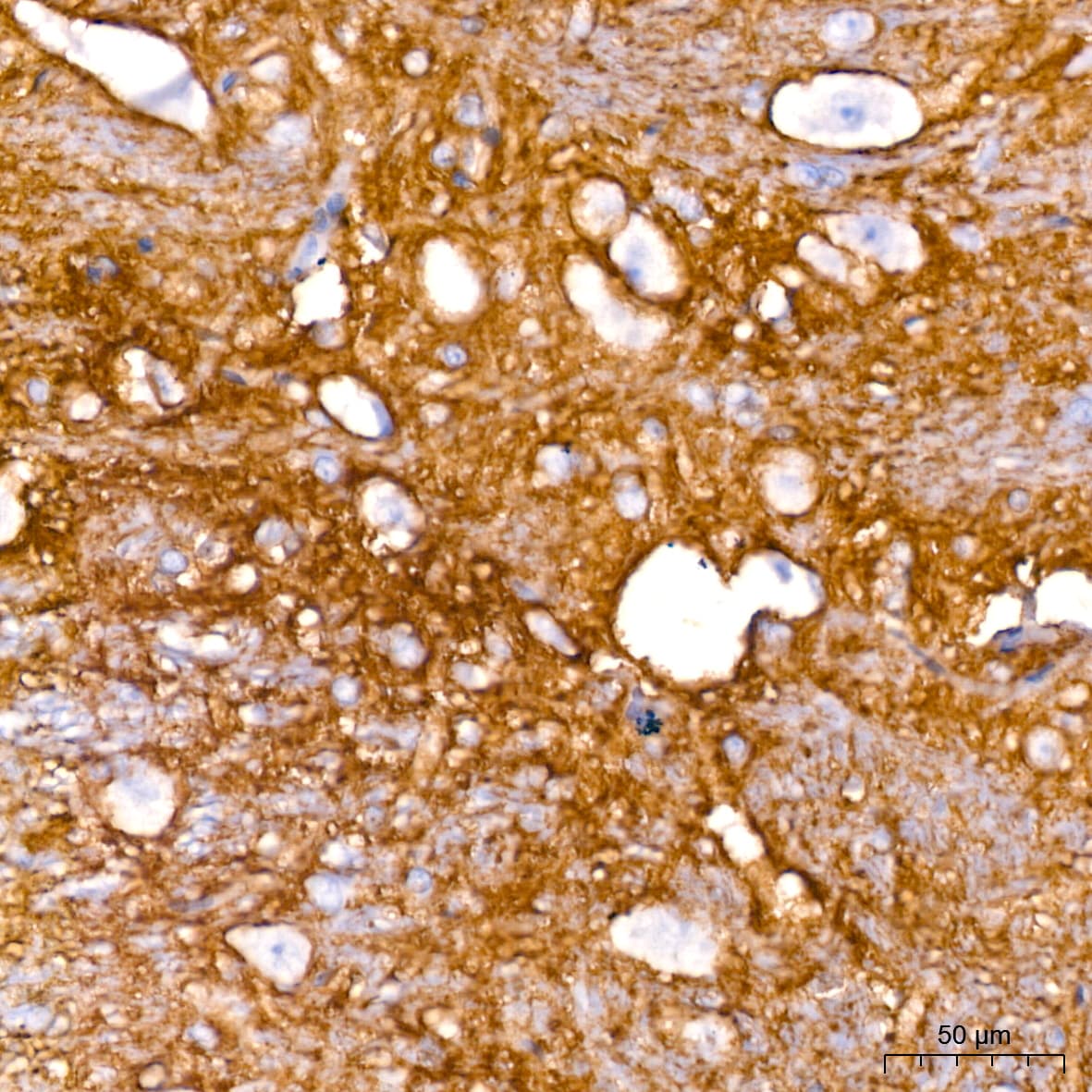 EAAT1/GLAST-1/SLC1A3 Antibody (7Y4U5)