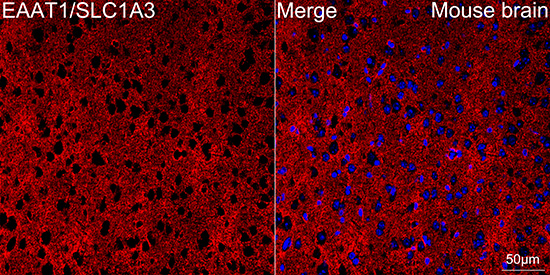 EAAT1/GLAST-1/SLC1A3 Antibody (7Y4U5)