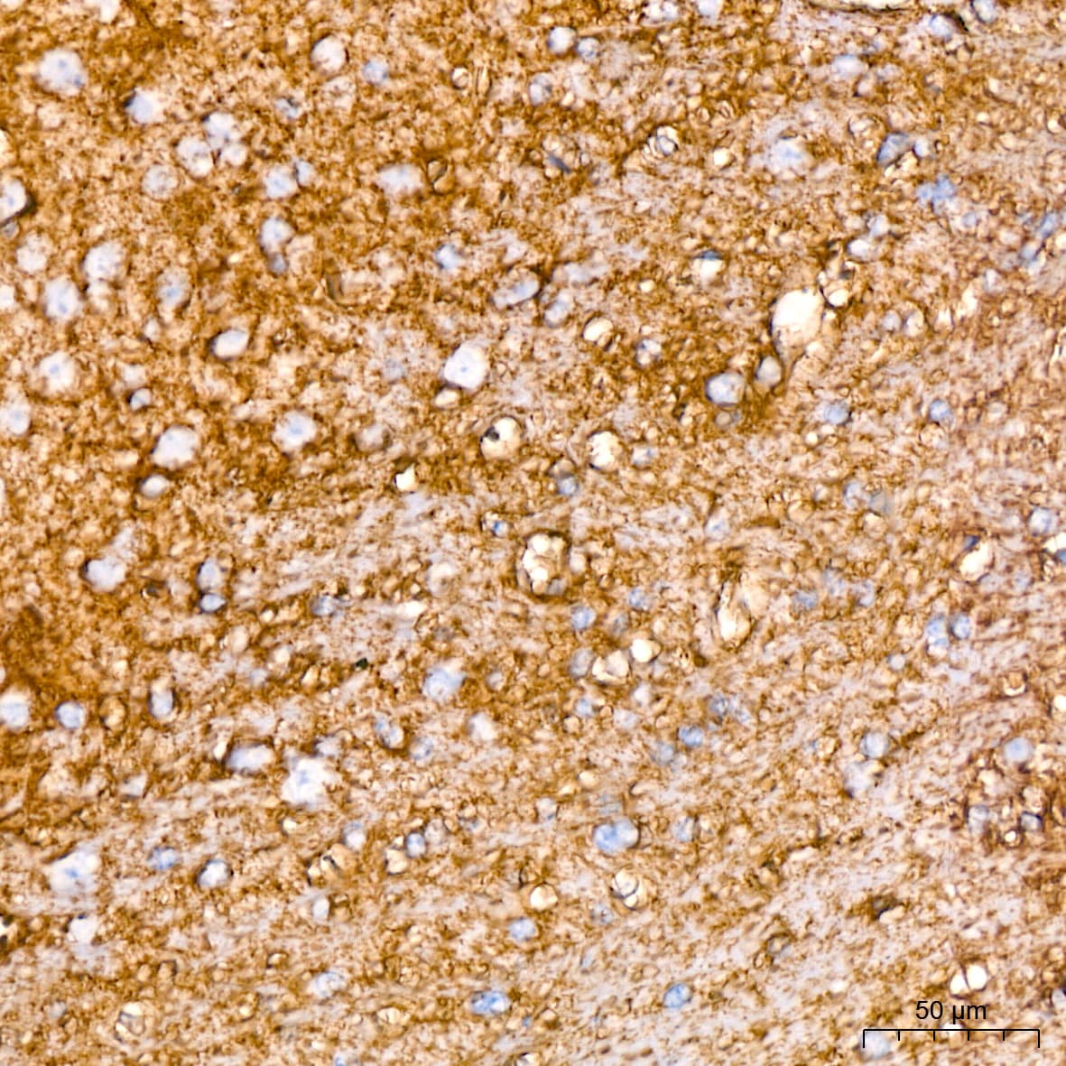 EAAT1/GLAST-1/SLC1A3 Antibody (7Y4U5)