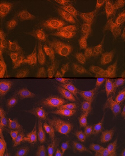 eEF-2 Antibody (4E2Z5)