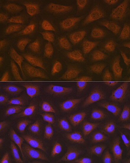 eEF-2 Antibody (4E2Z5)