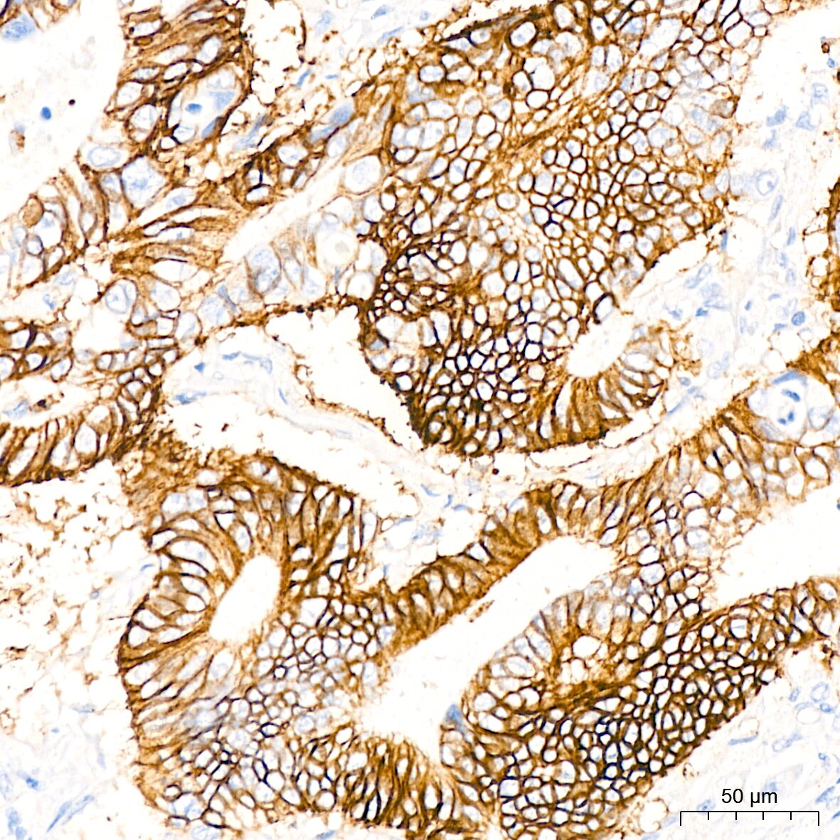 Glutamate Receptor 6 Antibody (4B4L9)