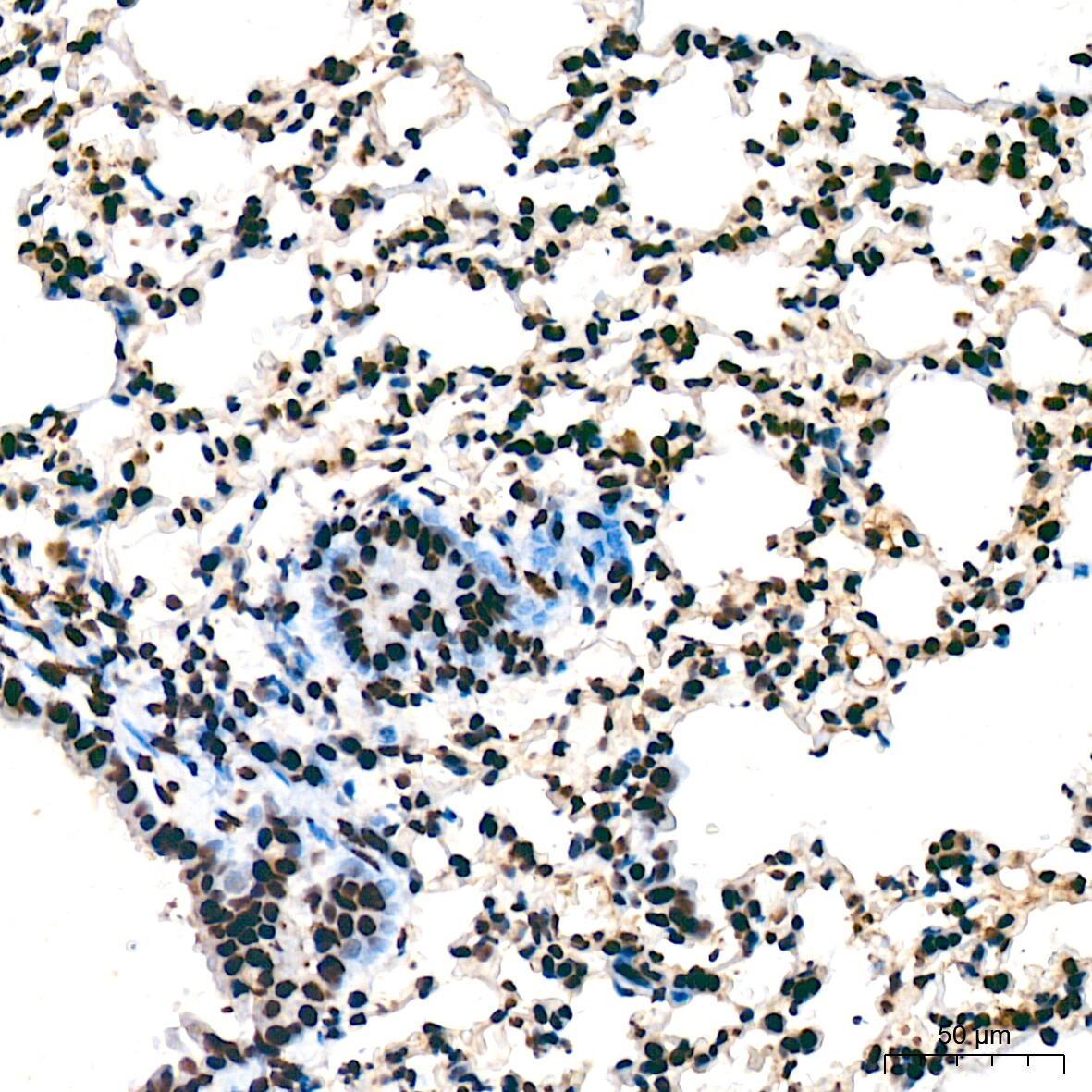 UAP56 Antibody (4A0Q2)