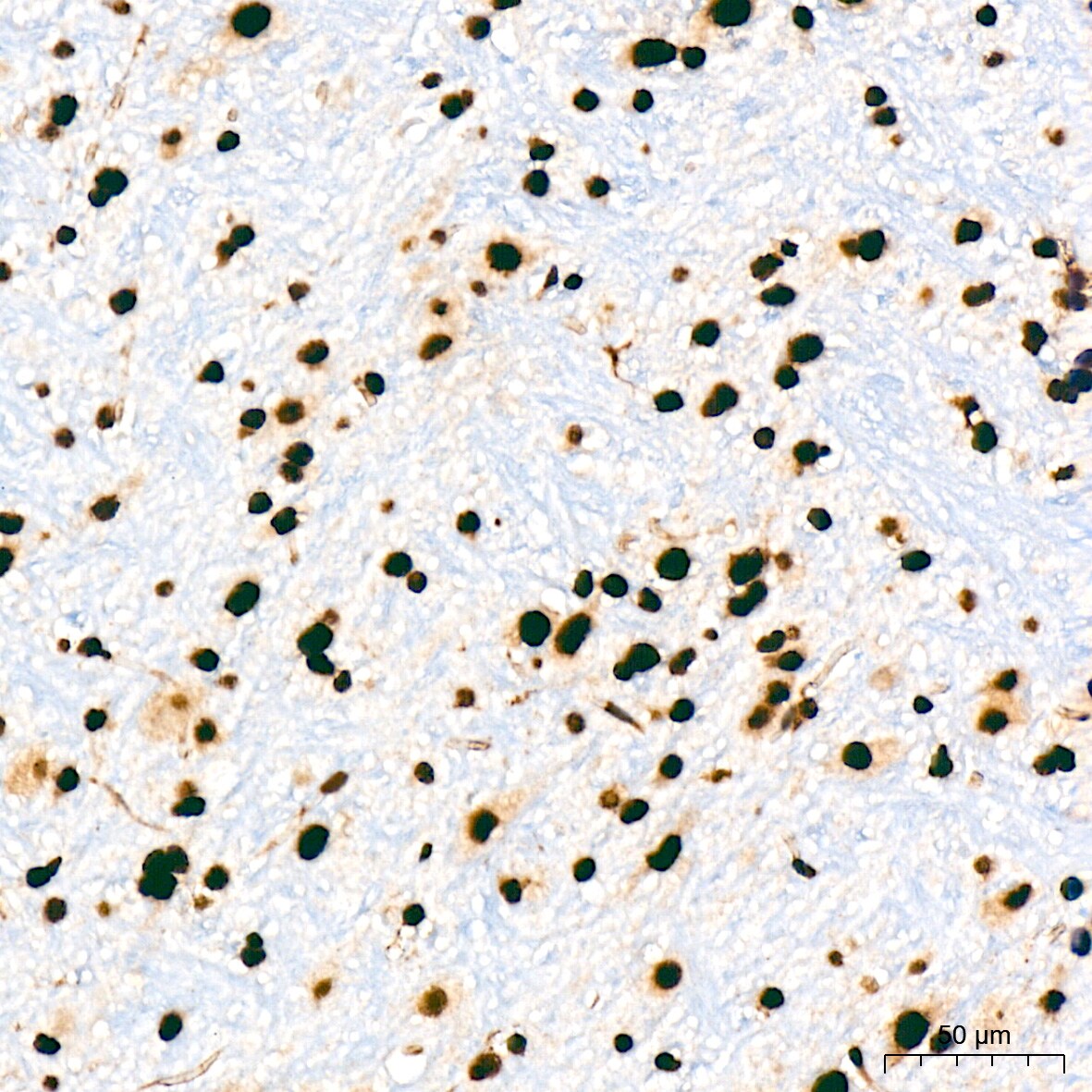 UAP56 Antibody (4A0Q2)