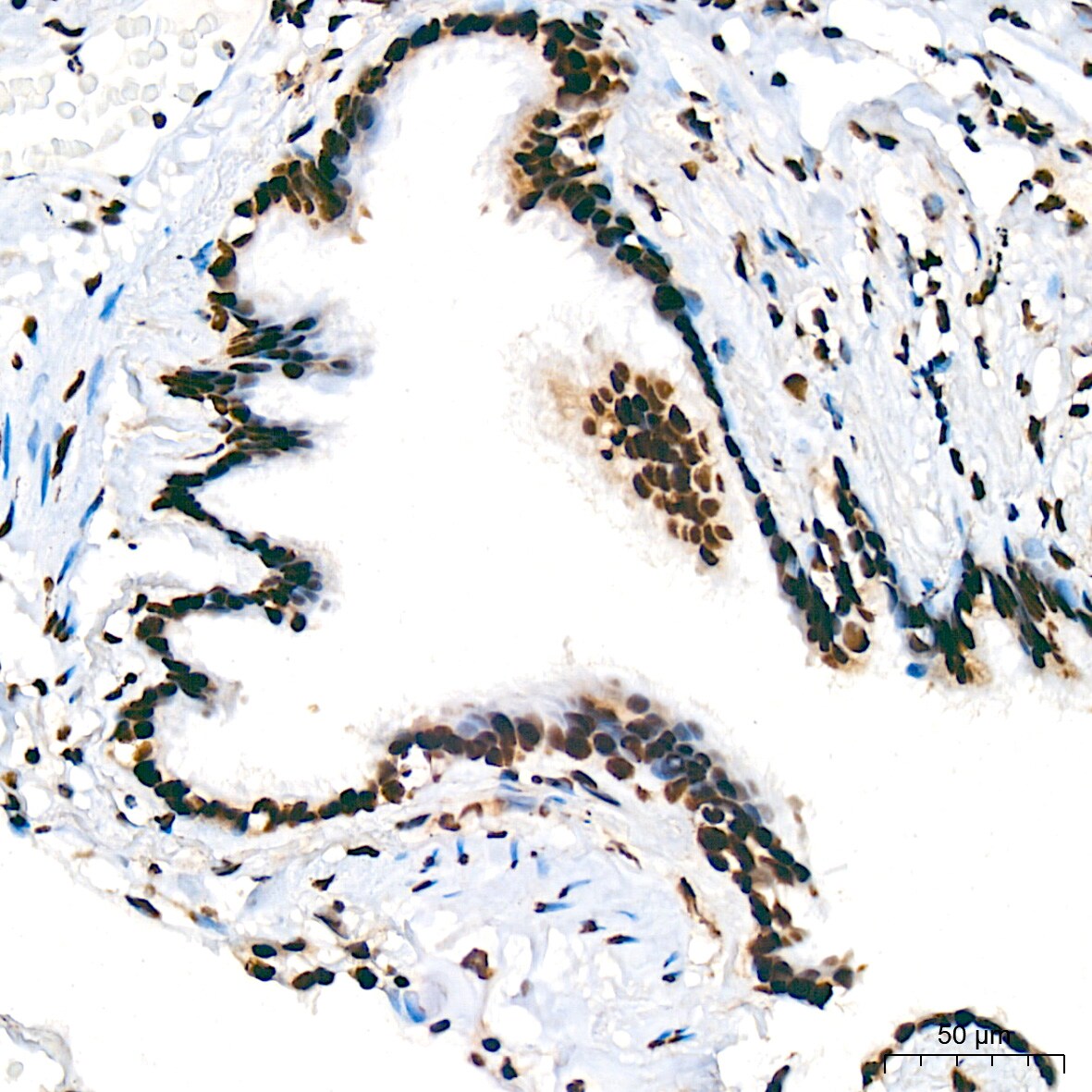 UAP56 Antibody (4A0Q2)