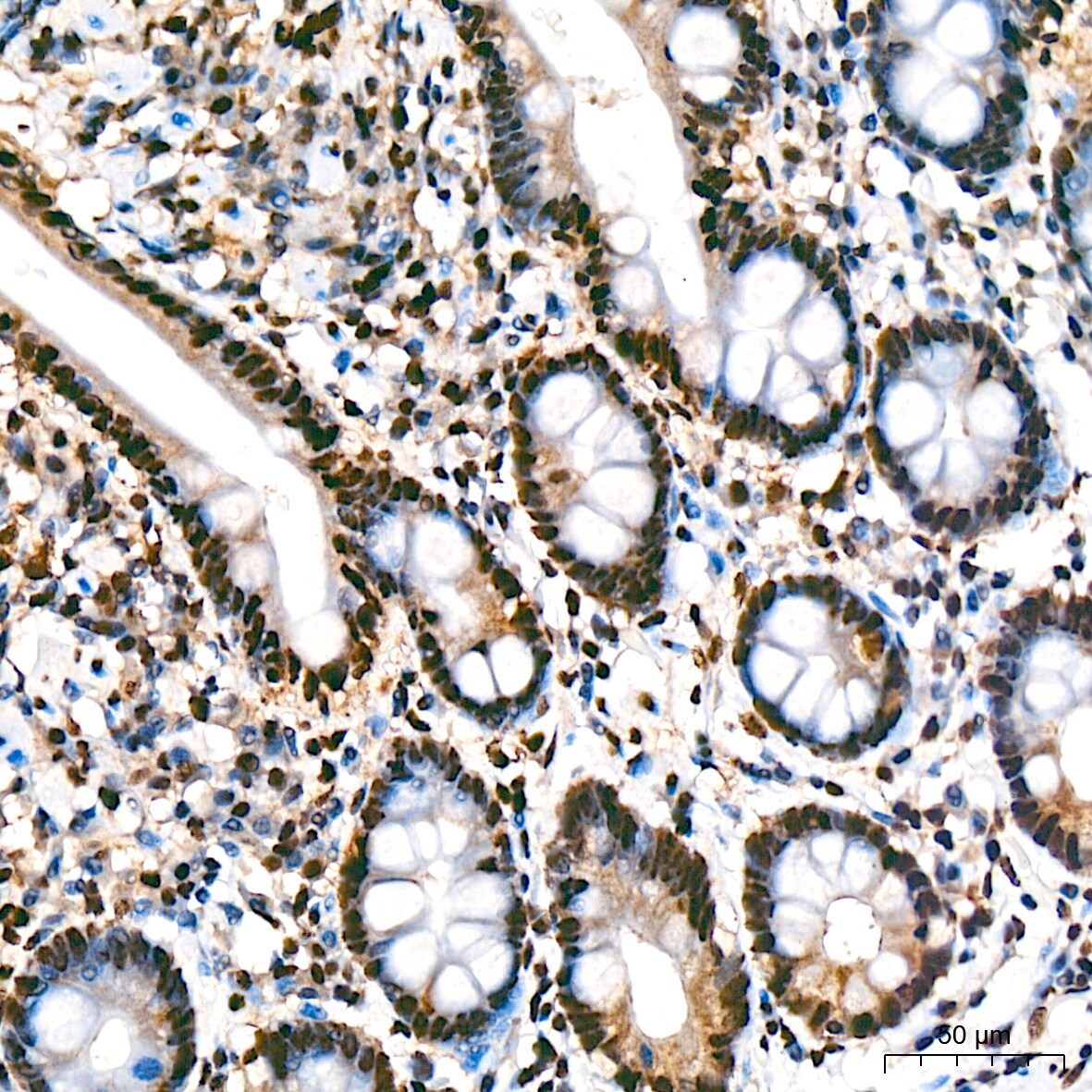 UAP56 Antibody (4A0Q2)