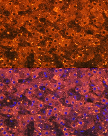 alpha 2-Macroglobulin Antibody (7V6M10)