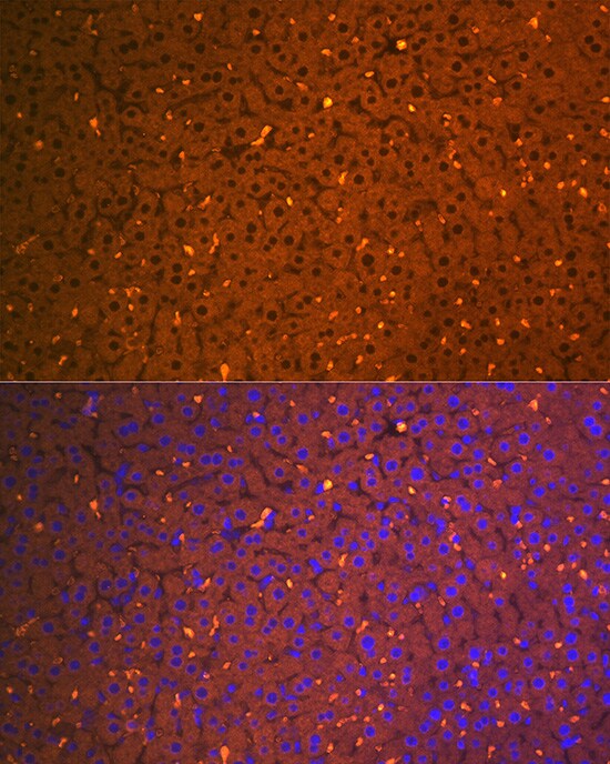 alpha 2-Macroglobulin Antibody (7V6M10)