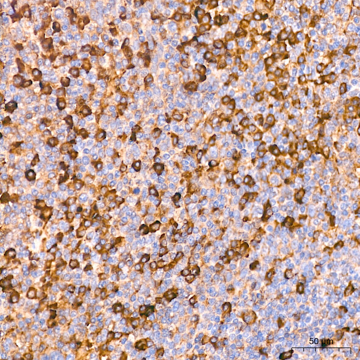 alpha 2-Macroglobulin Antibody (7V6M10)