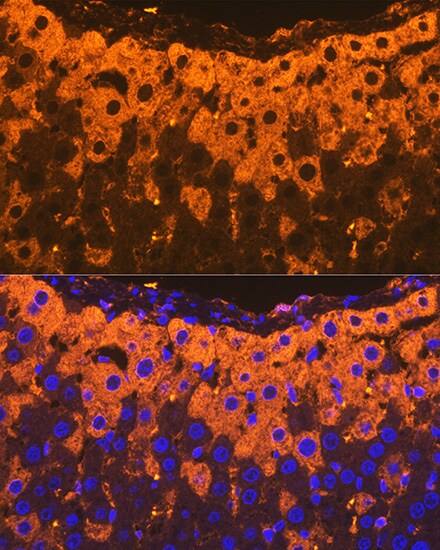 alpha 2-Macroglobulin Antibody (7V6M10)