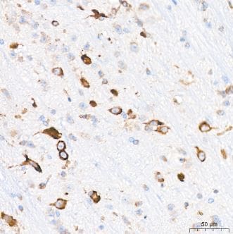 alpha 2-Macroglobulin Antibody (7V6M10)