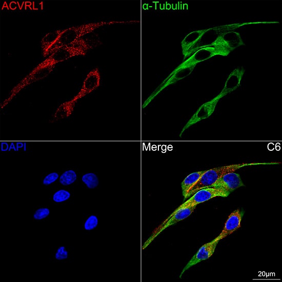 ALK-1 Antibody (8L2V7)