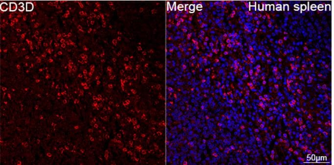 CD3 delta Antibody (2R1O10)