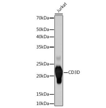 CD3 delta Antibody (2R1O10)