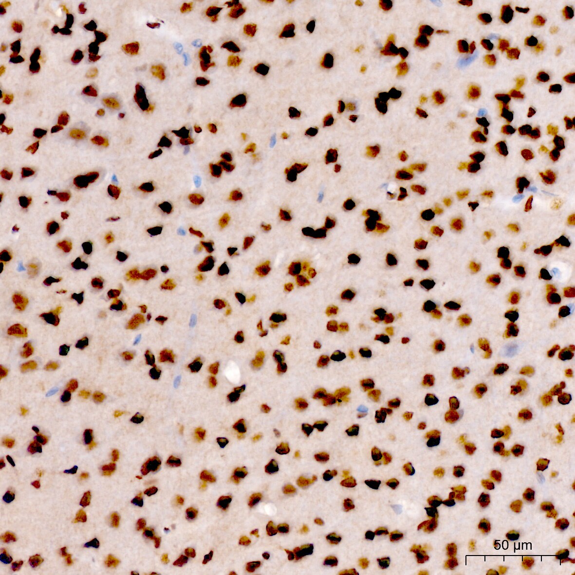 RNA Polymerase II/POLR2A [p Ser7] Antibody - Azide and BSA Free