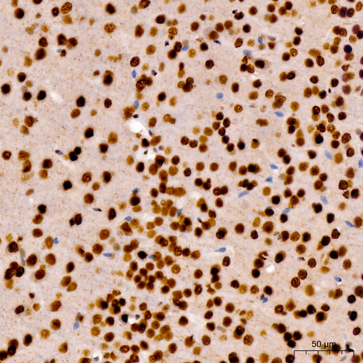 RNA Polymerase II/POLR2A [p Ser7] Antibody - Azide and BSA Free