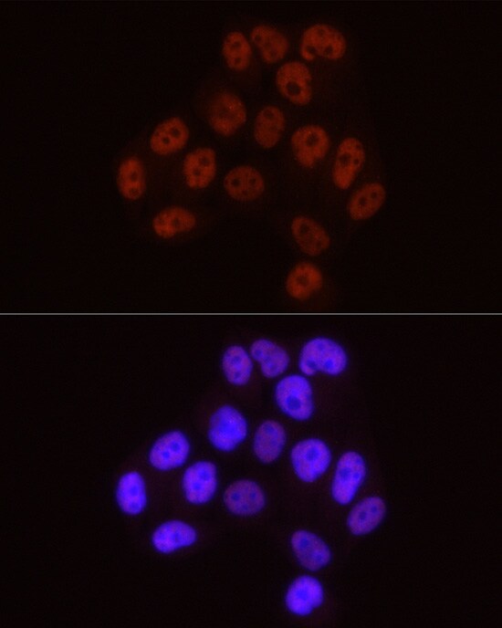 RNA Polymerase II/POLR2A [p Ser5] Antibody (10C7U2)