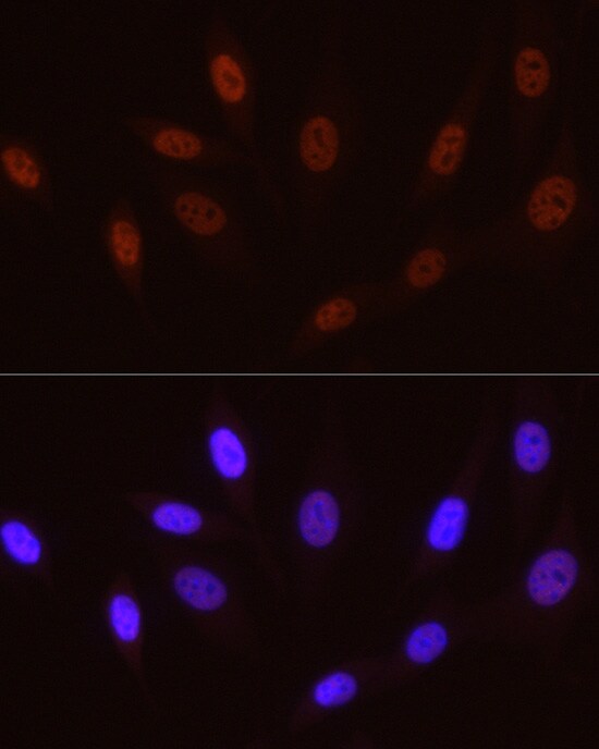 RNA Polymerase II/POLR2A [p Ser5] Antibody (10C7U2)
