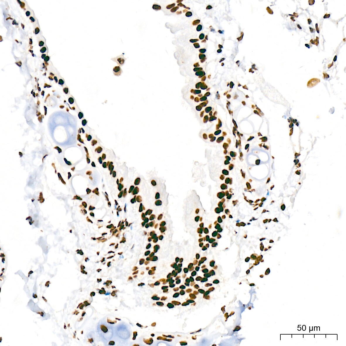 RNA Polymerase II/POLR2A [p Ser5] Antibody (10C7U2)