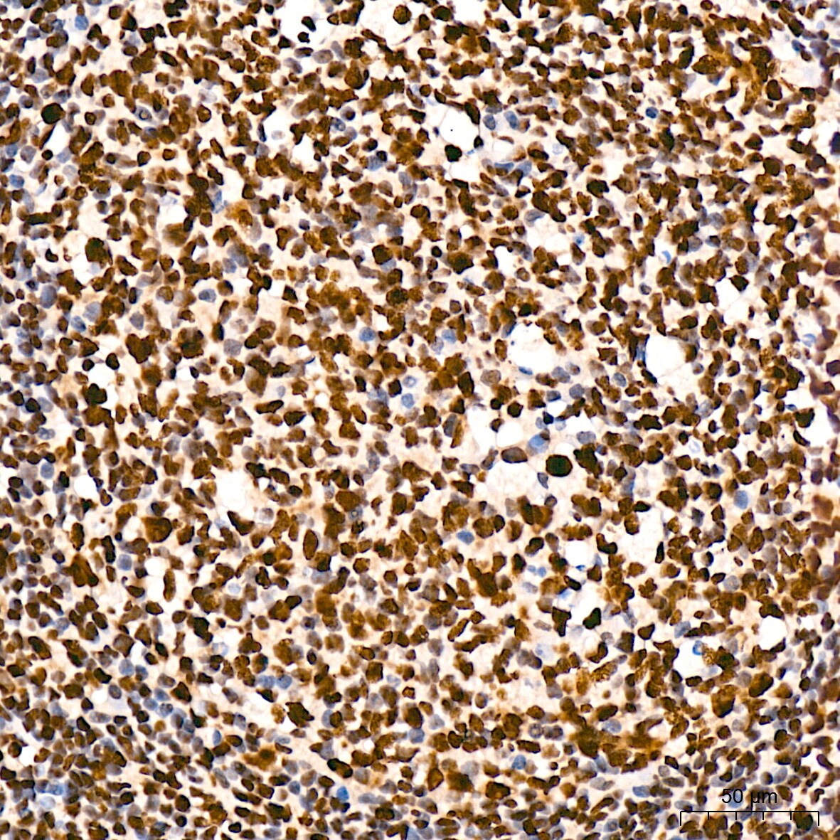 RNA Polymerase II/POLR2A [p Ser5] Antibody (10C7U2)