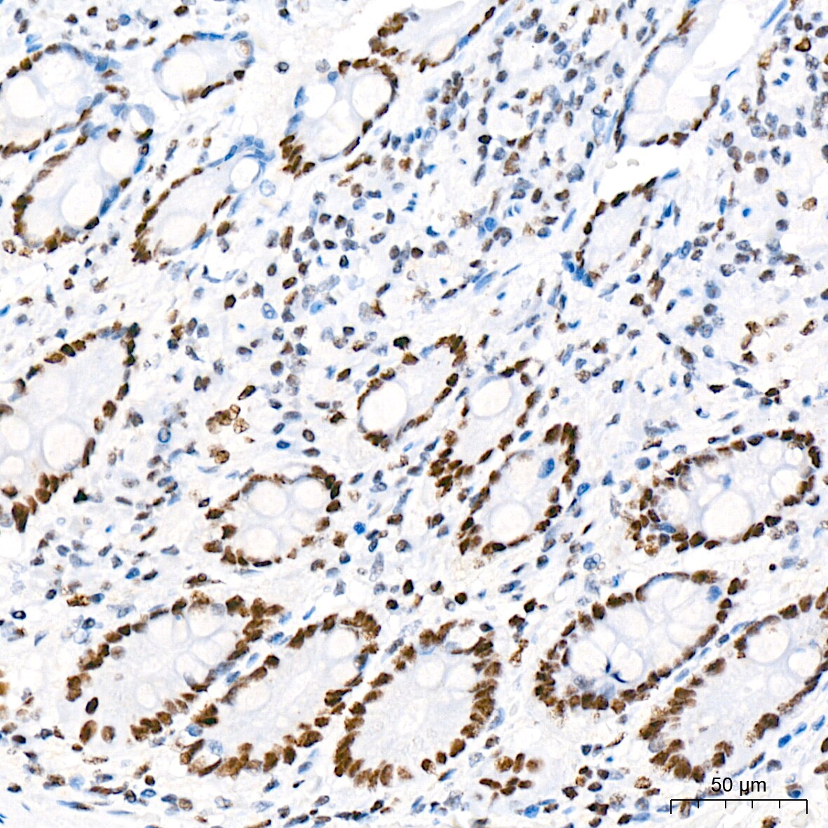 RNA Polymerase II/POLR2A [p Ser5] Antibody (10C7U2)