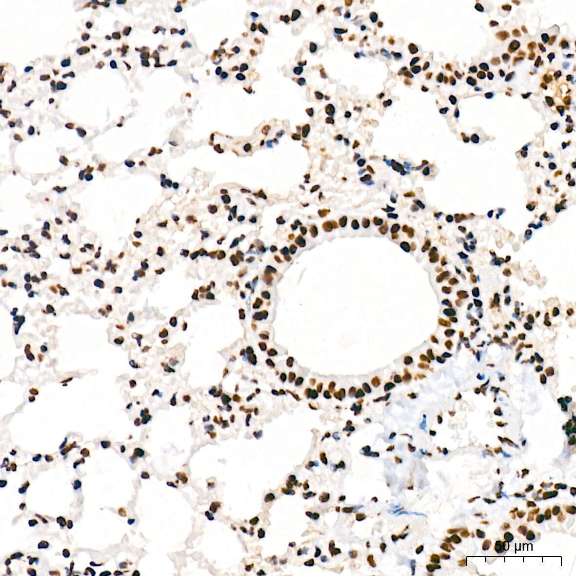RNA Polymerase II/POLR2A [p Ser5] Antibody (10C7U2)