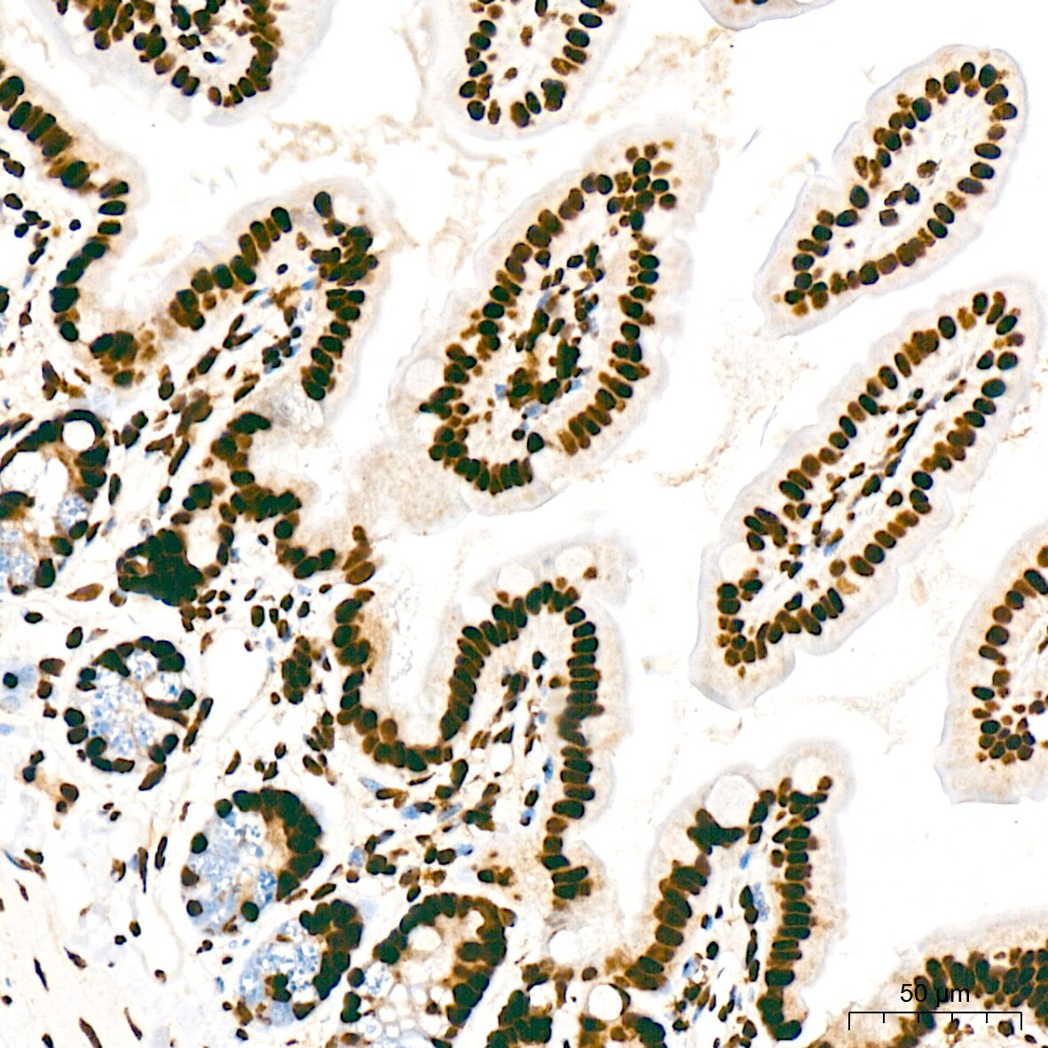 RNA Polymerase II/POLR2A [p Ser5] Antibody (10C7U2)