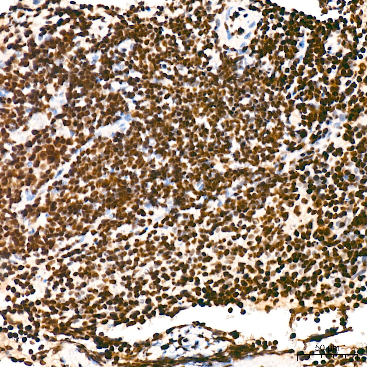 RNA Polymerase II/POLR2A [p Ser5] Antibody (10C7U2)