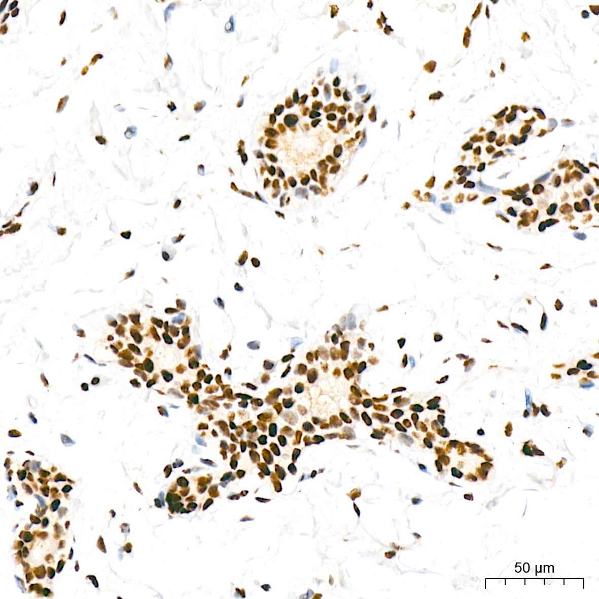 RNA Polymerase II/POLR2A [p Ser5] Antibody (10C7U2)
