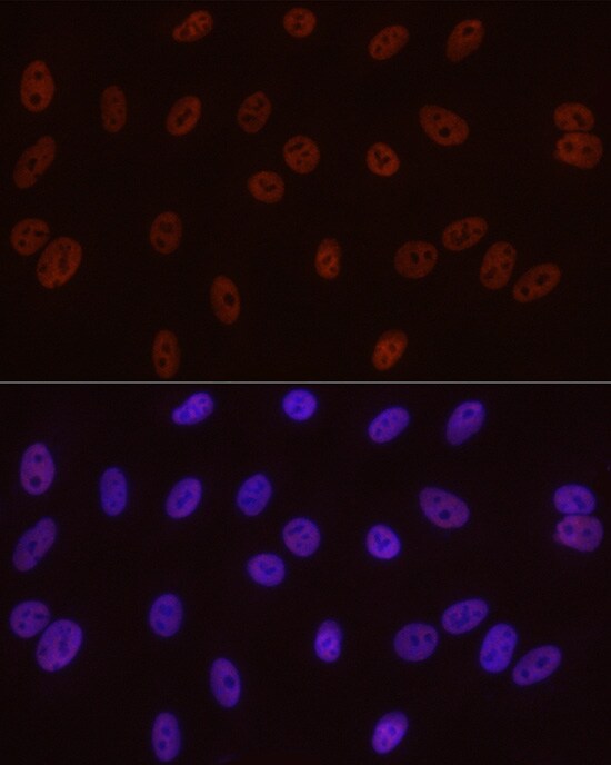 RNA Polymerase II/POLR2A [p Ser5] Antibody (10C7U2)