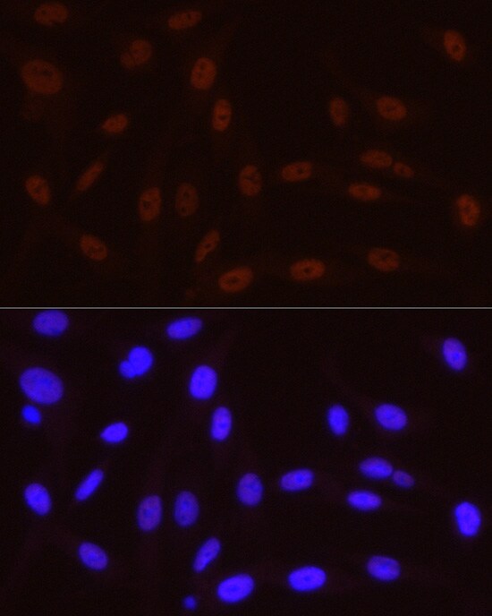 RNA Polymerase II/POLR2A [p Ser5] Antibody (10C7U2)