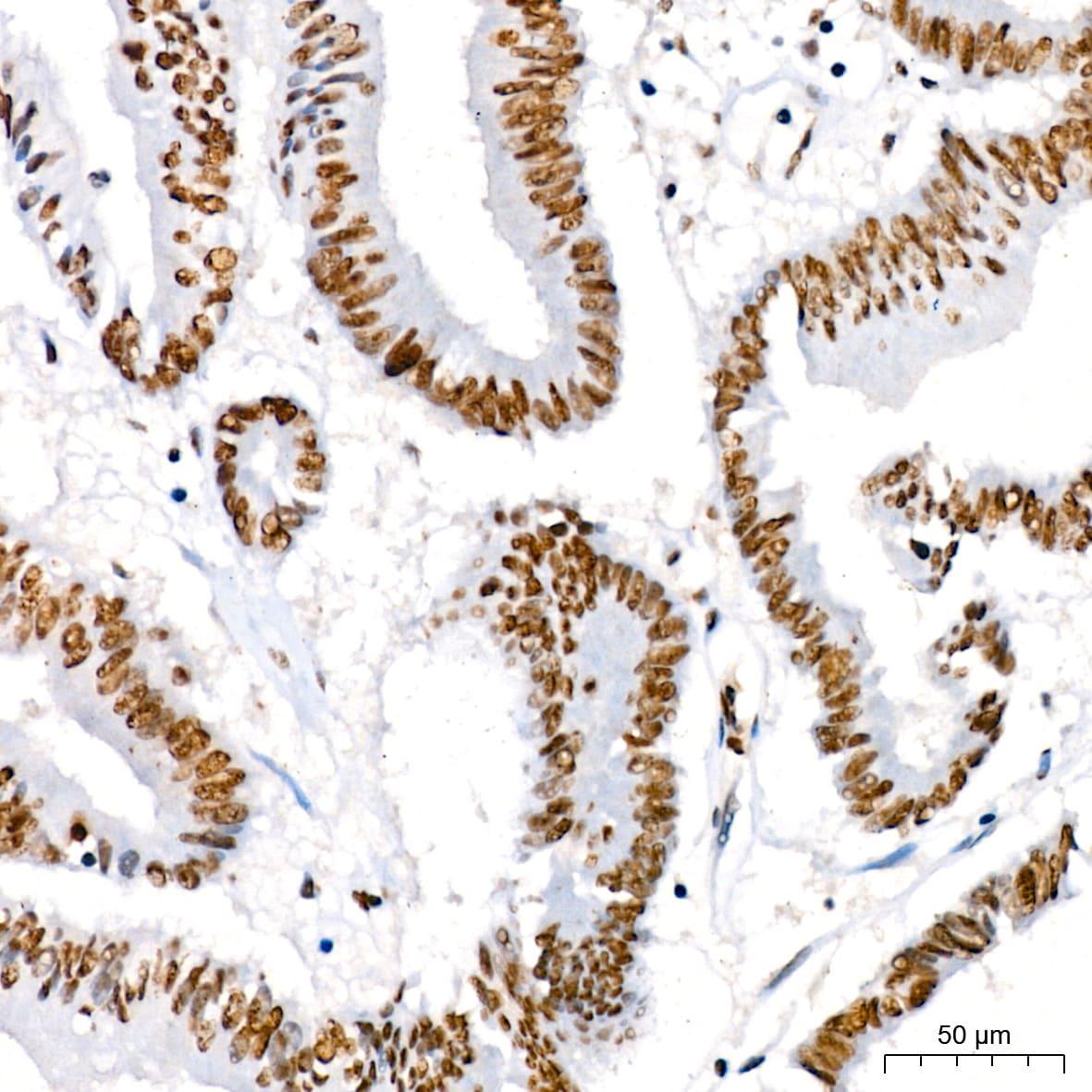 IkB-alpha [p Ser36] Antibody (8G1X10)