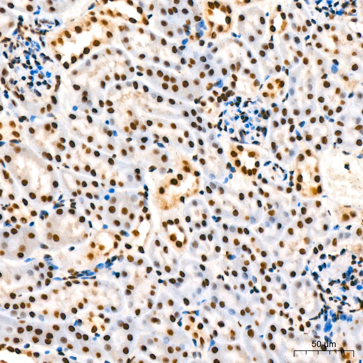 IkB-alpha [p Ser36] Antibody (8G1X10)