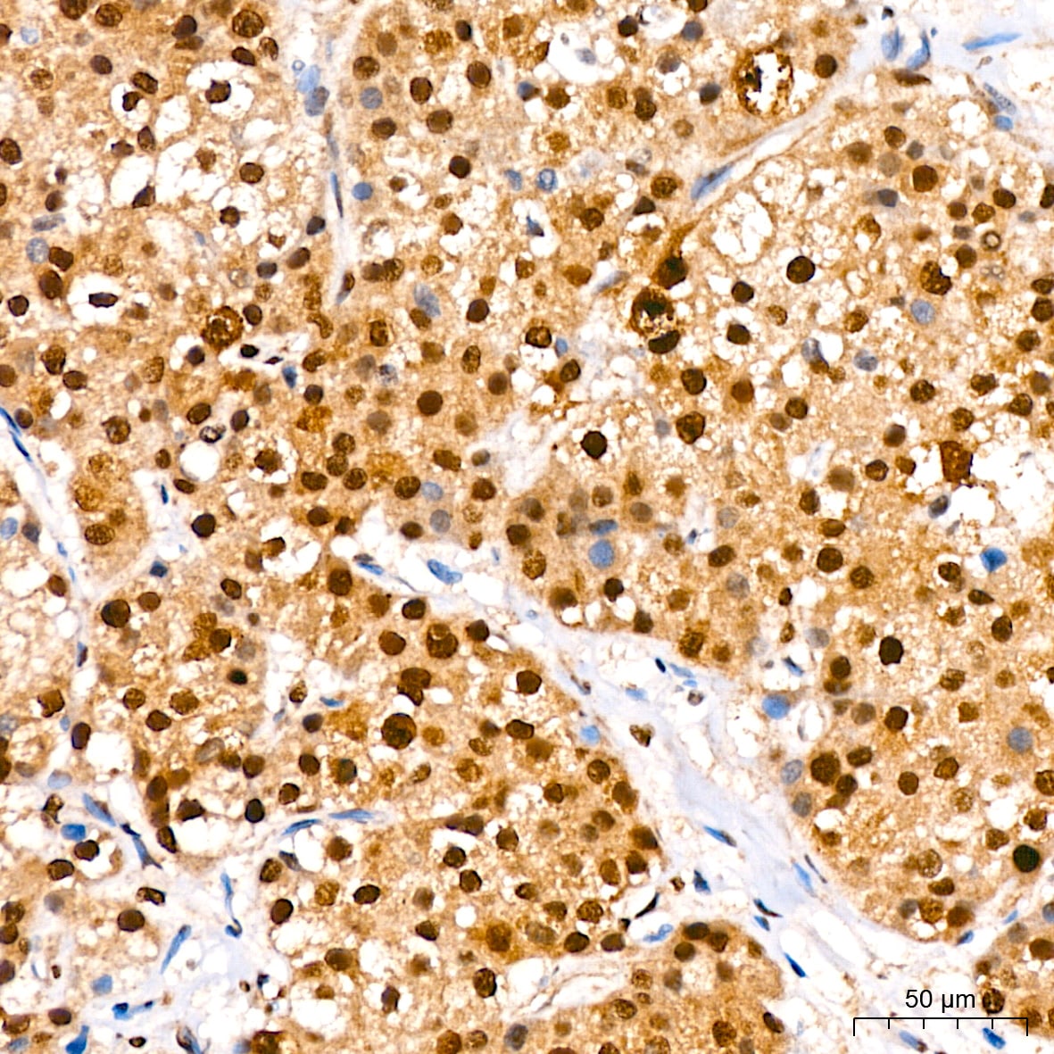 IkB-alpha [p Ser36] Antibody (8G1X10)